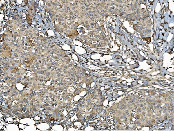 a03813 2 pdia6 primary antibodies ihc testing 4