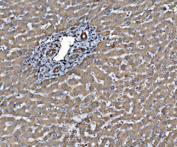 a03813 2 pdia6 primary antibodies ihc testing 5