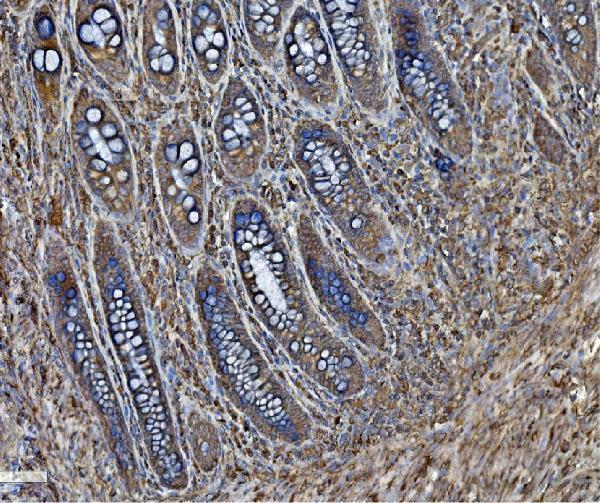 a03813 2 pdia6 primary antibodies ihc testing 6