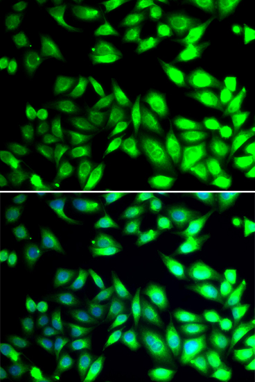 a03813 pdia6 primary antiboties if testing 2
