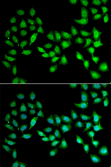 a03814 ucn2 primary antiboties if testing 3