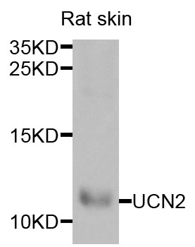a03814 ucn2 primary antiboties wb testing 1