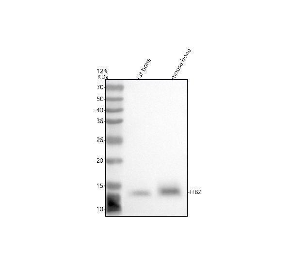  Western blot analysis of HBZ using anti-HBZ antibody (A03815-1)