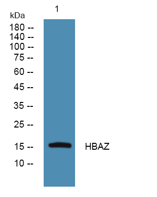 Western blot analysis of lysates from SW480 cells, primary antibody was diluted at 1:1000, 4°over night