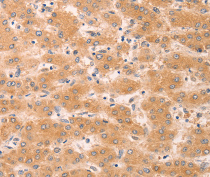 a03817 gna11 primary antiboties ihc testing 2