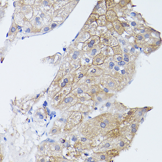 a03817 gna11 primary antiboties ihc testing 3