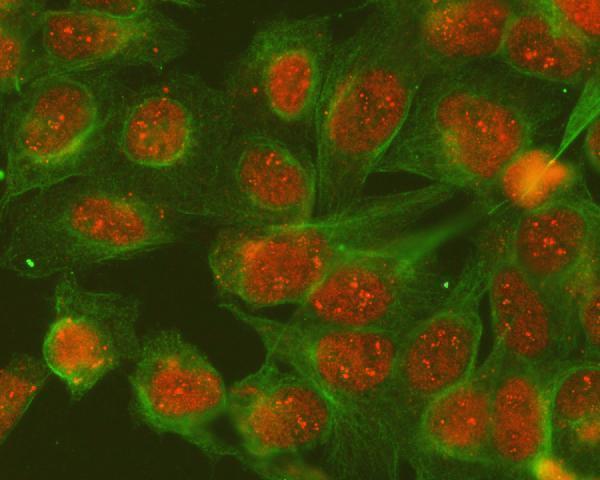  IF analysis of SGTA and Tubulin alpha using anti-SGTA antibody (A03818-1) and anti-Tubulin alpha antibody (M03989-3)