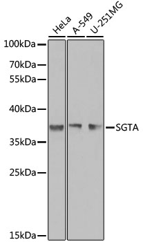 a03818 sgta primary antiboties wb testing 1