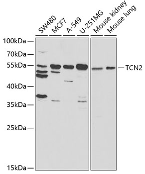 Western blot analysis of extracts of various cell lines, using TCN2 antibody  at 1:1000 dilution
