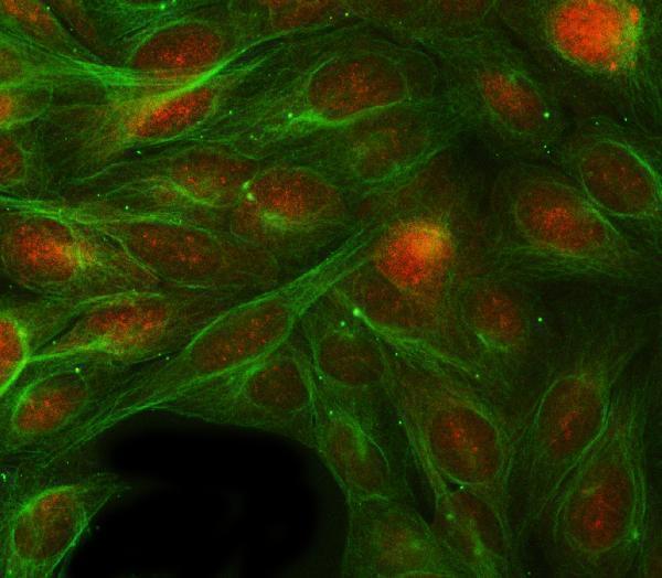a03820 4 rbp1 primary antibodies if testing 7