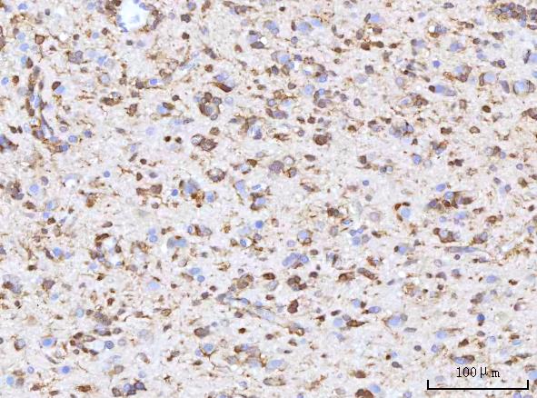  IHC analysis of RBP1 using anti-RBP1 antibody (A03820-4)