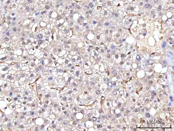  IHC analysis of RBP1 using anti-RBP1 antibody (A03820-4)