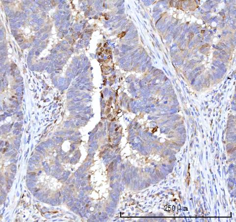 a03820 4 rbp1 primary antibodies ihc testing 4