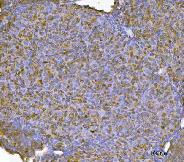 a03820 4 rbp1 primary antibodies ihc testing 5