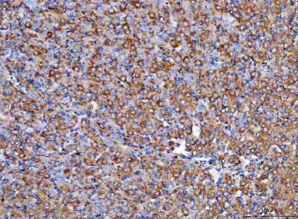 a03820 4 rbp1 primary antibodies ihc testing 6