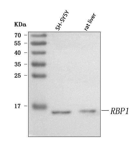  Western blot analysis of RBP1 using anti-RBP1 antibody (A03820-4)