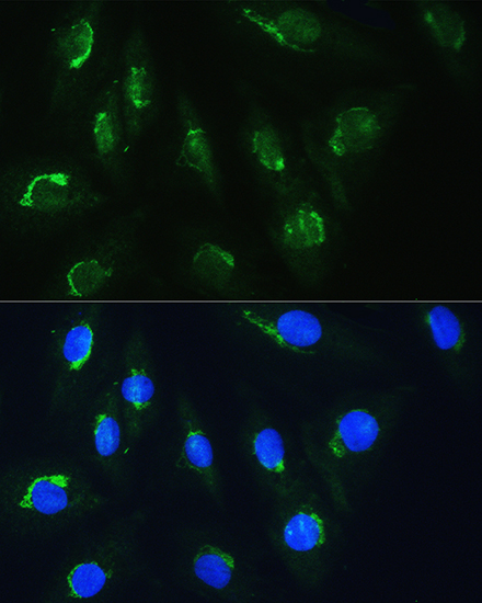 Immunofluorescence analysis of H9C2 cells using NBAS Rabbit pAb  at dilution of 1:100