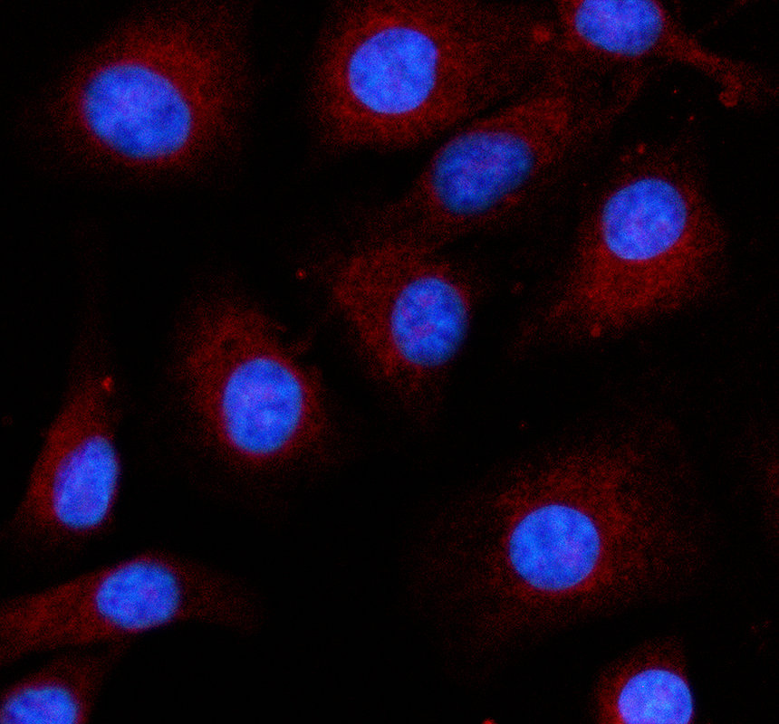 IF analysis of MAP3K14 using anti-MAP3K14 antibody (A03822-1)