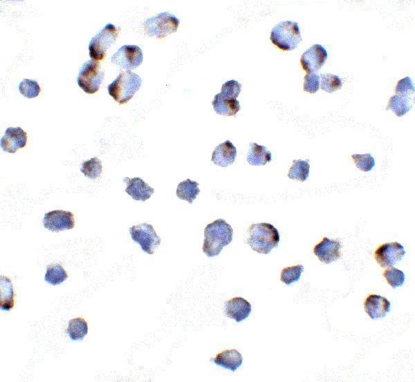 Immunocytochemistry of NIK in Hek293 cells with NIK antibody at 10 μg/mL