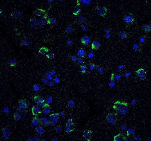 Immunofluorescence of NIK in Hek293 cells with NIK antibody at 20 μg/mL