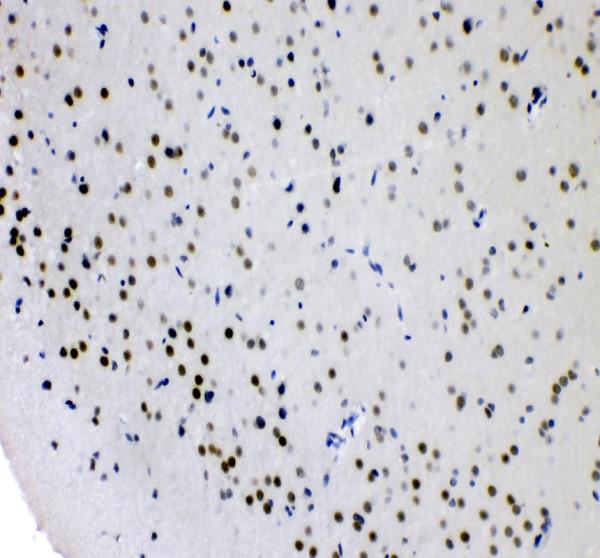 IHC analysis of AFF4 using anti-AFF4 antibody (A03824)