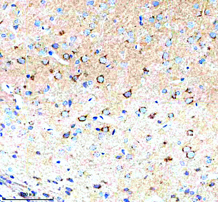 IHC analysis of MANF using anti-MANF antibody (A03825-2)