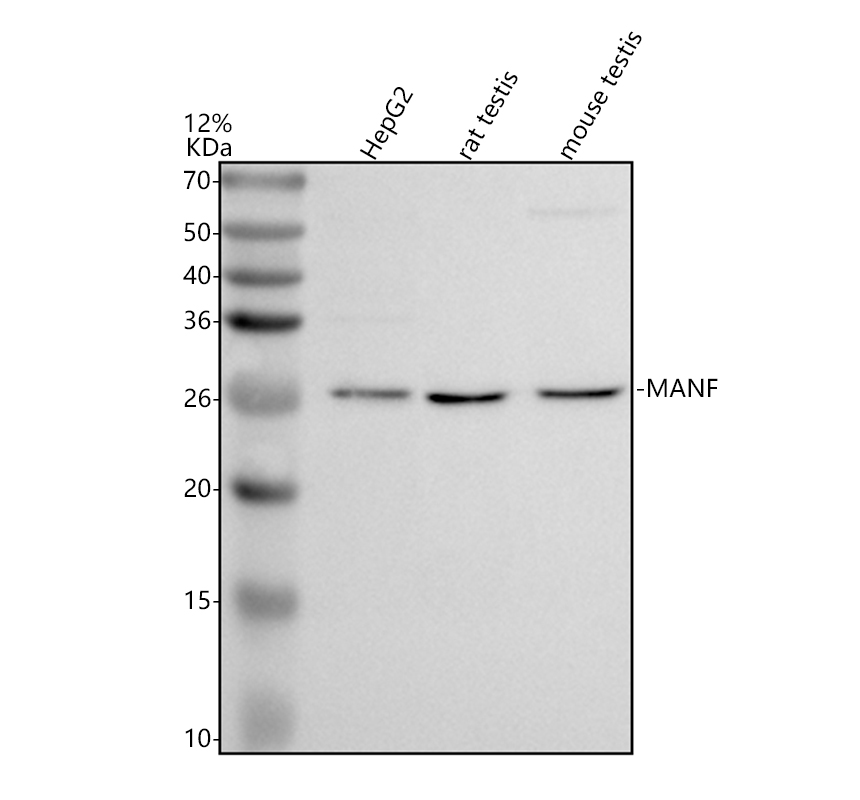 Western blot analysis of MANF using anti-MANF antibody (A03825-2)