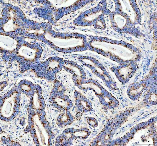 a03826 1 ddx6 primary antibodies ihc testing 1