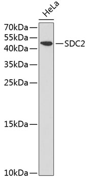 a03827 sdc2 primary antiboties wb testing 1