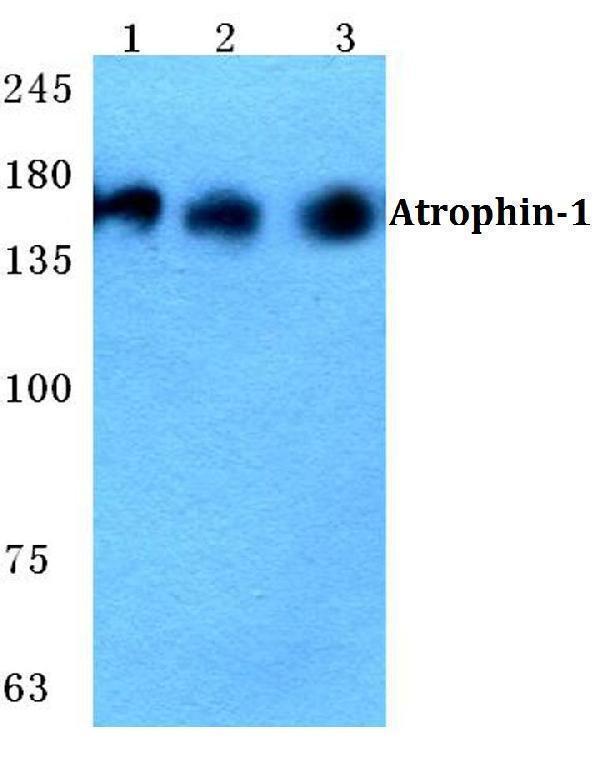 Western blot (WB) analysis of Atrophin-1 polyclonal antibody at 1:500 dilution
Lane1:HEK293T cell lysate
Lane2:sp2/0 cell lysate
Lane3:H9C2 cell lysate