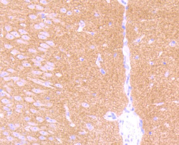 Immunohistochemical analysis of paraffin-embedded mouse brain tissue using anti- GABA B Receptor 2 antibody