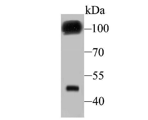 Western blot analysis of GABA B Receptor 2 on mouse cerebellum tissue lysate using anti- GABA B Receptor 2 antibody at 1/500 dilution