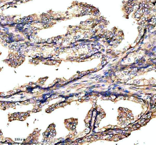 IHC analysis of GABBR2 using anti-GABBR2 antibody (A03830-2)