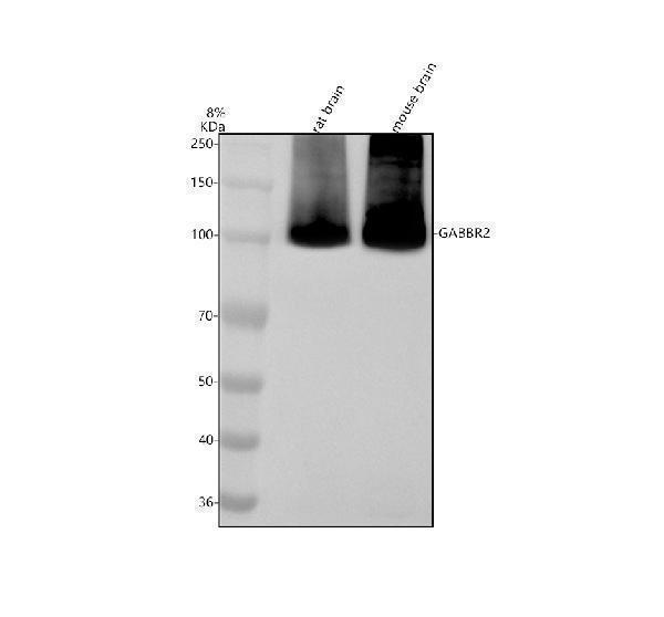 Western blot analysis of GABBR2 using anti-GABBR2 antibody (A03830-2)