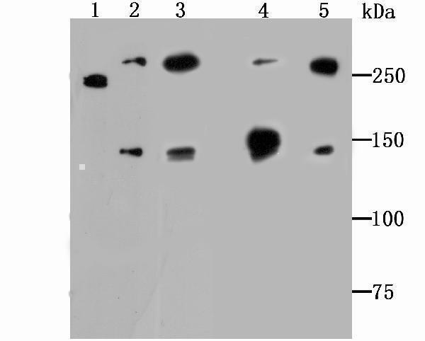 Western blot analysis of Alpha Fodrin on different lysates using anti-Alpha Fodrin antibody at 1/500 dilution