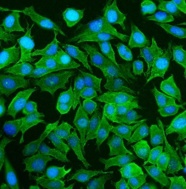 a03831 3 sptan1 primary antibodies if testing 7