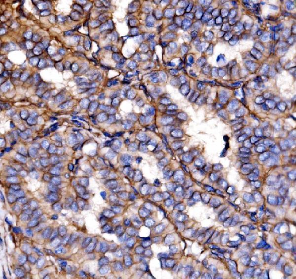  IHC analysis of NEAS/SPTAN1 using anti-NEAS/SPTAN1 antibody (A03831-3)