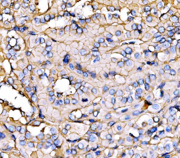  IHC analysis of NEAS/SPTAN1 using anti-NEAS/SPTAN1 antibody (A03831-3)