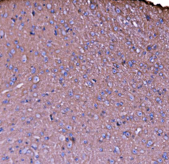 a03831 3 sptan1 primary antibodies ihc testing 5