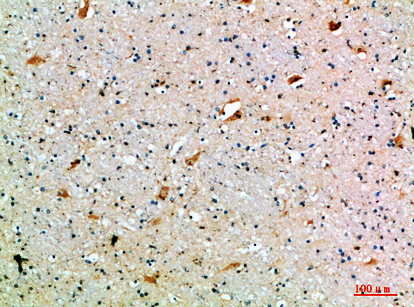 Immunohistochemical analysis of paraffin-embedded human-brain, antibody was diluted at 1:200