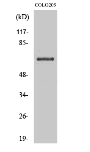 Western blotting validation for Anti-CD108 SEMA7A Antibody A03832
Western Blot (WB) analysis of specific cells using CD108 polyclonal antibody