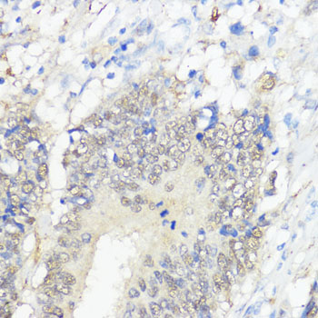 a03837 gpx2 primary antiboties ihc testing 2