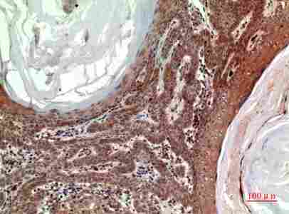 a03838 inhbb primary antibodyes ihc testing 3