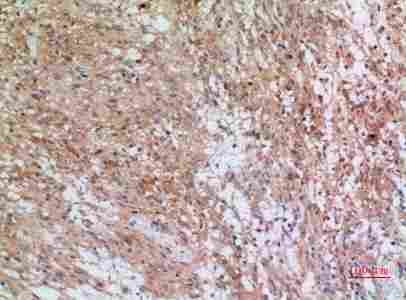 a03838 inhbb primary antibodyes ihc testing 4