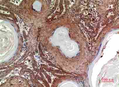 a03838 inhbb primary antibodyes ihc testing 5