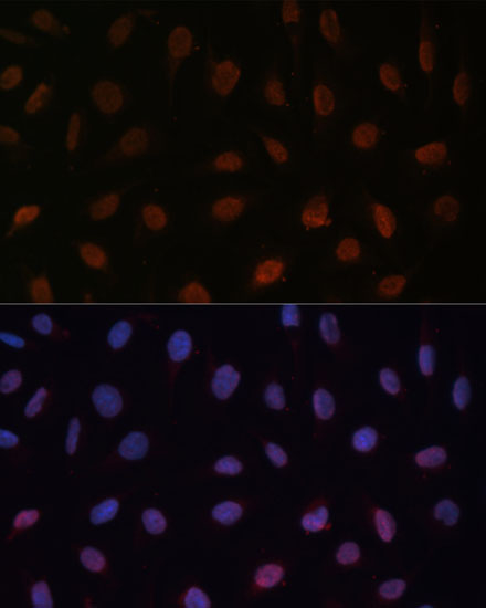 Immunofluorescence analysis of U-2 OS cells using MED25 Polyclonal Antibody  at dilution of 1:100 