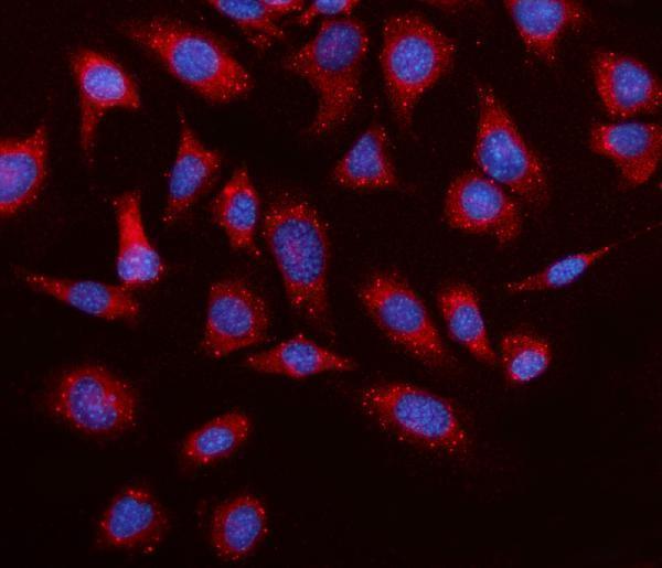  IF analysis of Elovl4 using anti-Elovl4 antibody (A03840-1)