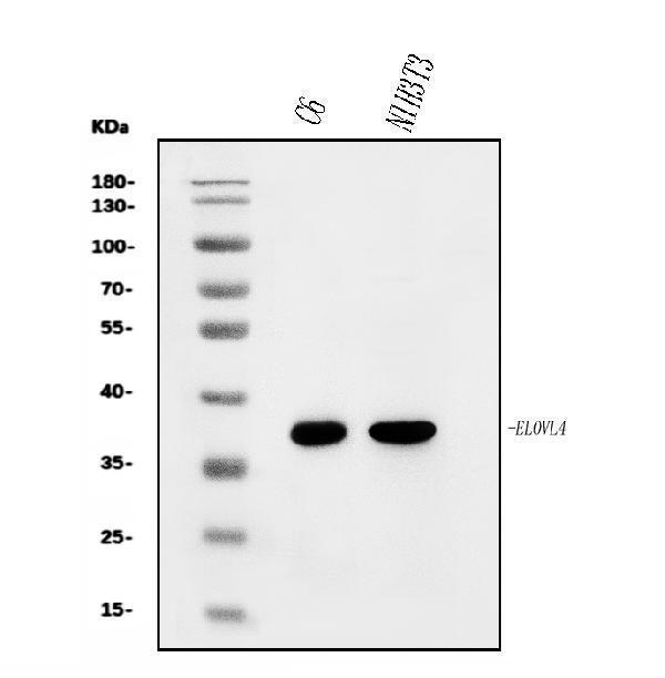  Western blot analysis of Elovl4 using anti-Elovl4 antibody (A03840-1)