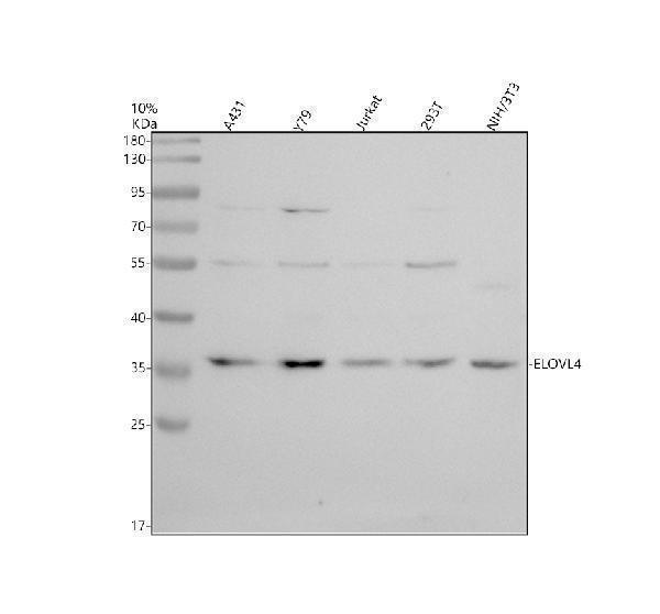 Western blot analysis of ELOVL4 using anti-ELOVL4 antibody (A03840-2)