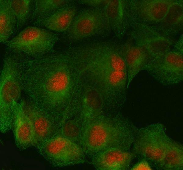  IF analysis of FAF1 using anti-FAF1 antibody (A03842-1) and anti-Beta Tubulin antibody (M01857-3)